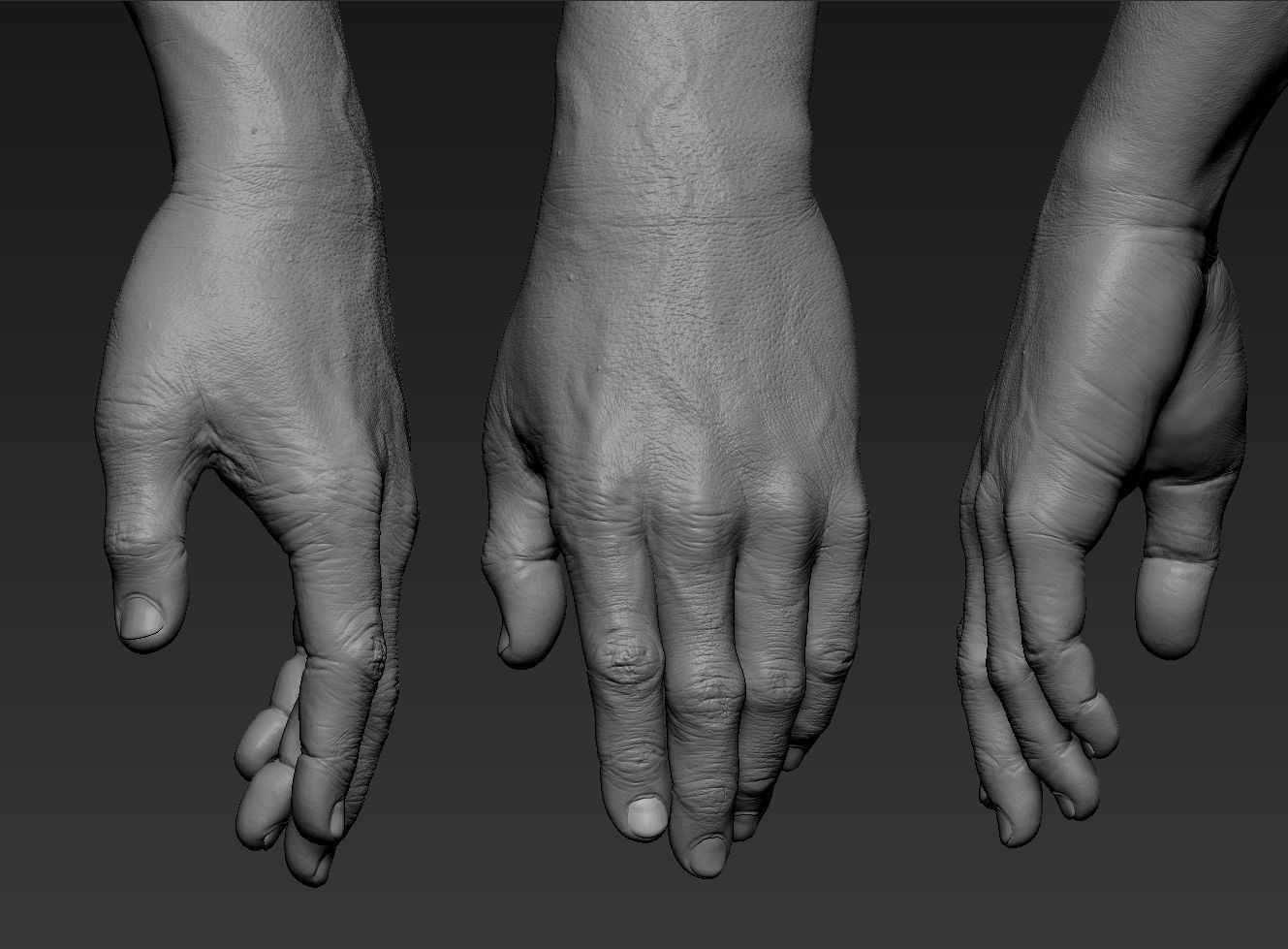 Бионические протезы рук, которые можно приобрести в россии